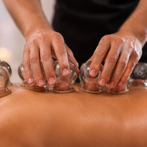 Cupping Therapy Session