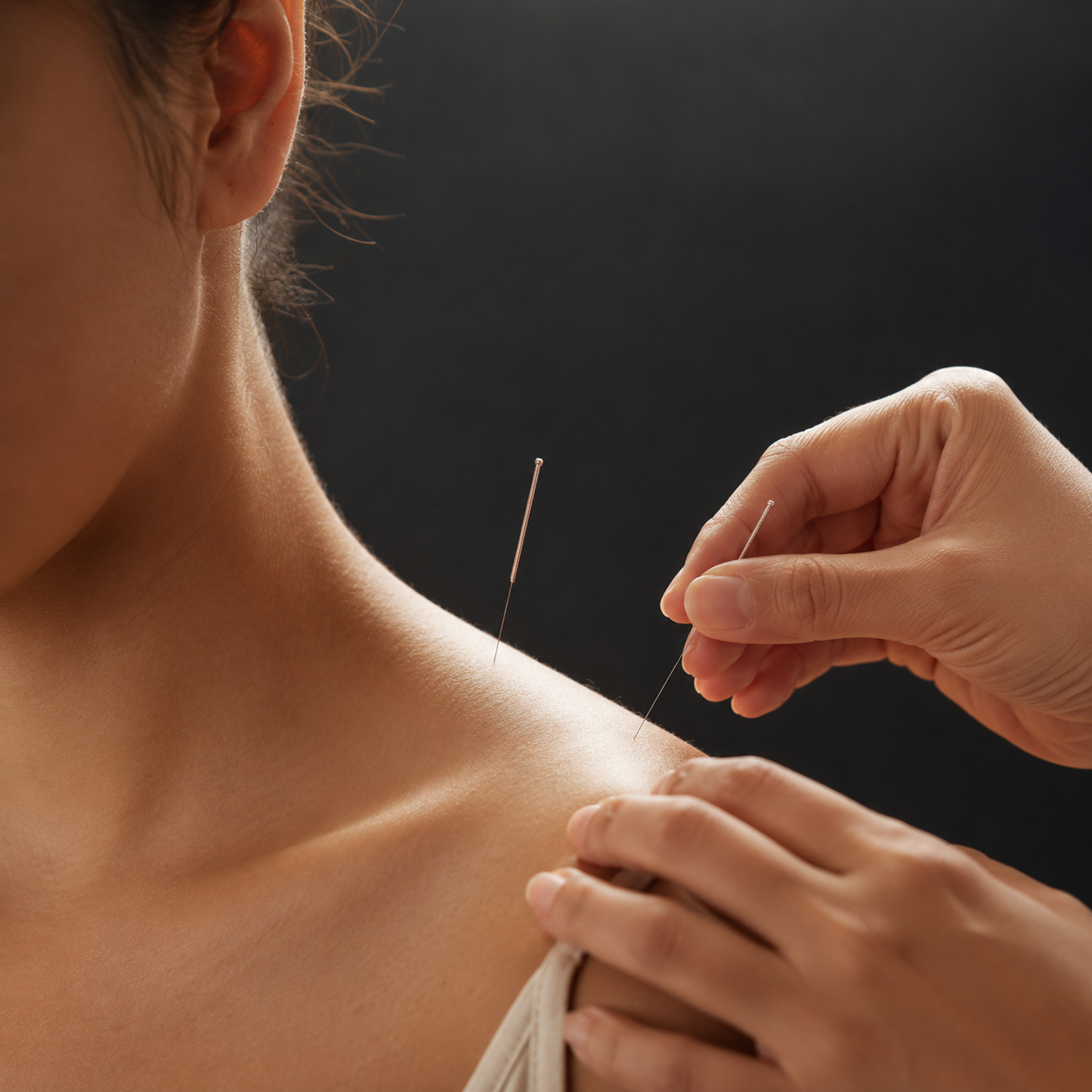 meridian-acupuncture